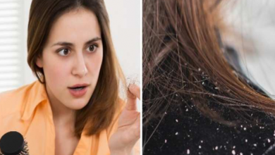 Photo of दो चम्मच नीबू का रस दूर कर सकते हैं आपके बालों से जिद्दी डैन्ड्रफ की समस्या